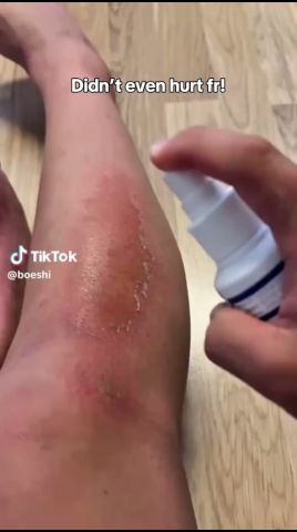 TikTok 广告素材