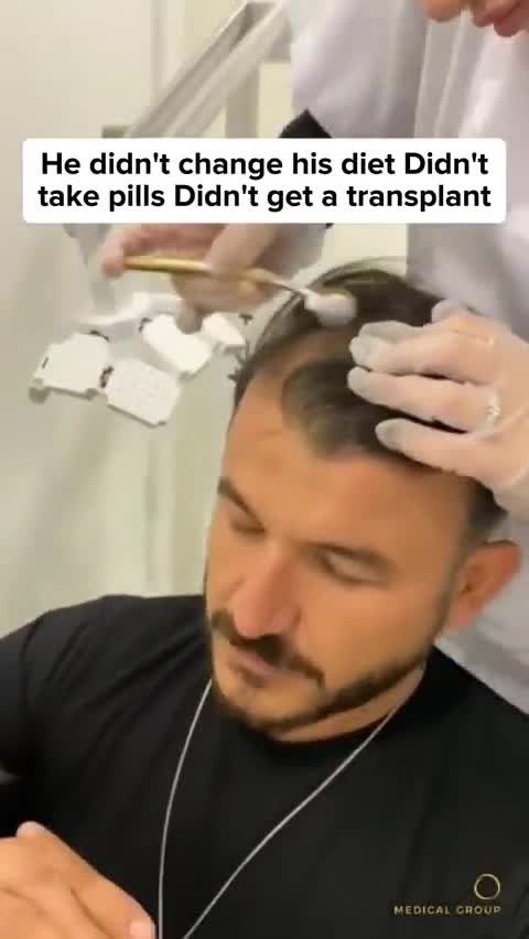 Kiierr Laser Hair Growth Cap: 2021’s Best Laser Cap for Hair Loss ad creative